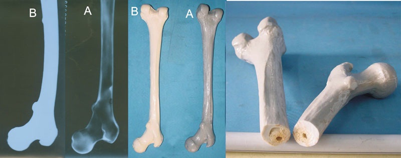 Medical Demonstration Human Skeleton Model (R010101)