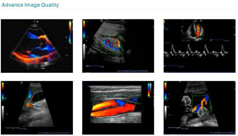 THR-CD003Q 3D Color Doppler Ultrasound Scanner