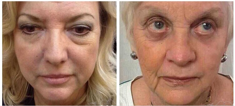 New Arrival Instantly Ageless Eye Cream Anti Wrinkle Cream 2 Minutes Effective