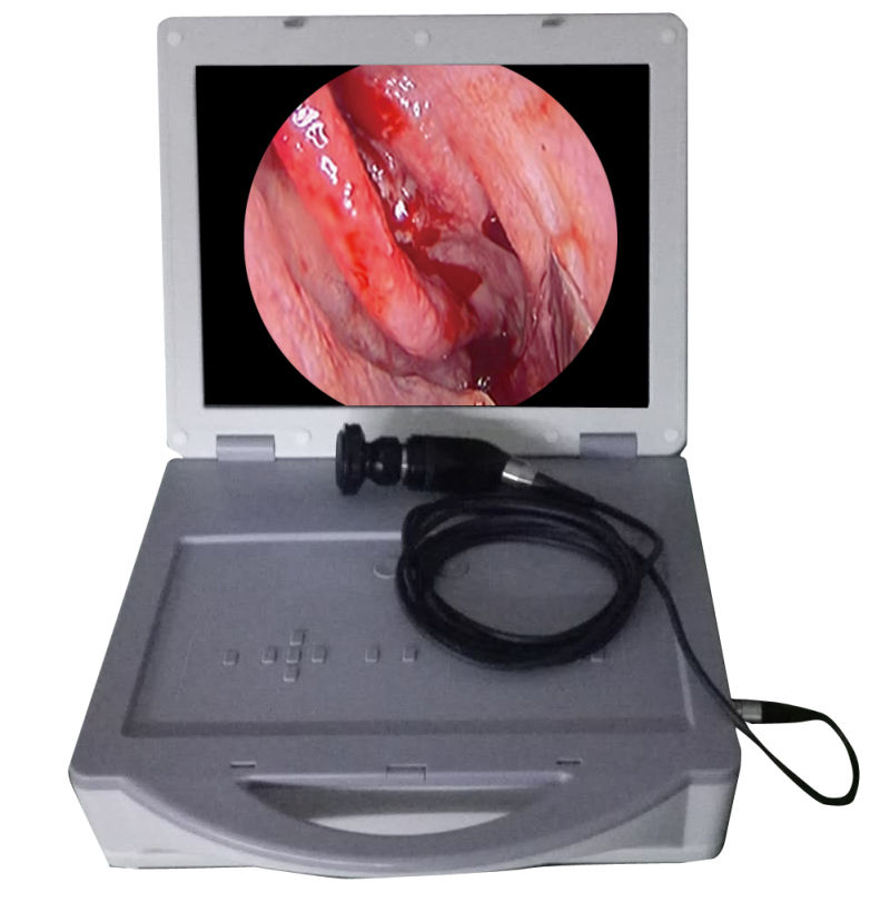 Portable Medical HD Endoscope Camera