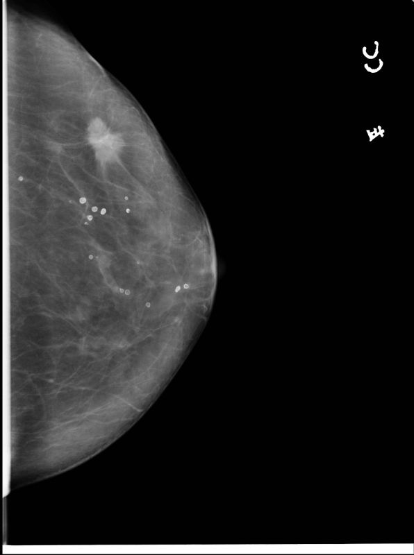 Xm30 Mammography X-ray