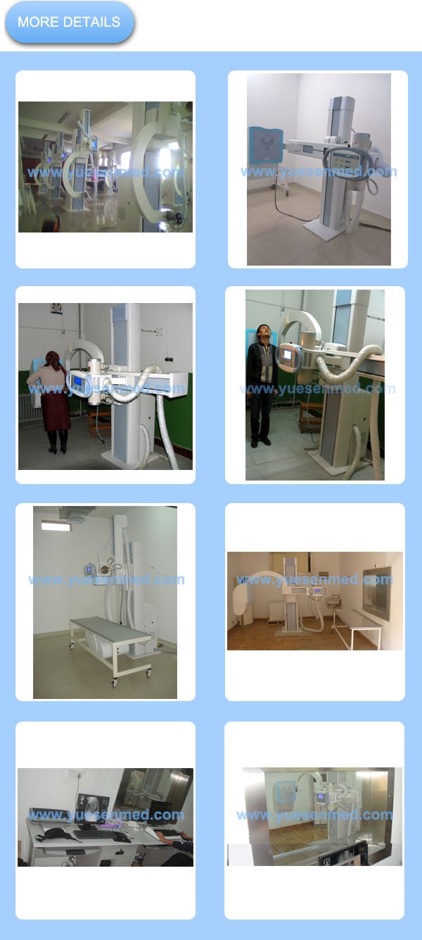 Hospital Medical 32kw Uc-Arm Digital X Ray Machine