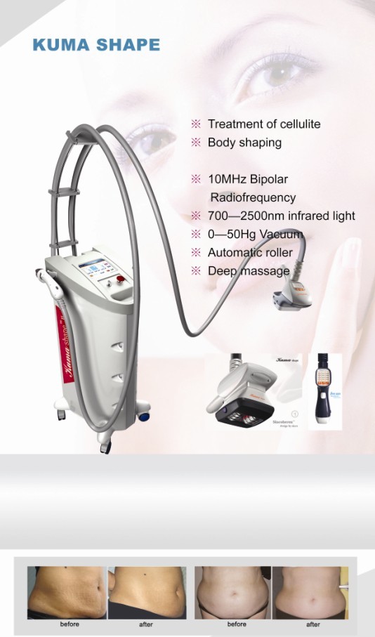 Hot Sale Acoustic Wave Therapy RF Vacuum Kuma Shape 3 Cellulite Removal