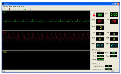 Patient Monitor Module Bluetooth Six- Parameter OEM Module Pm6750 with Standard Accessoies