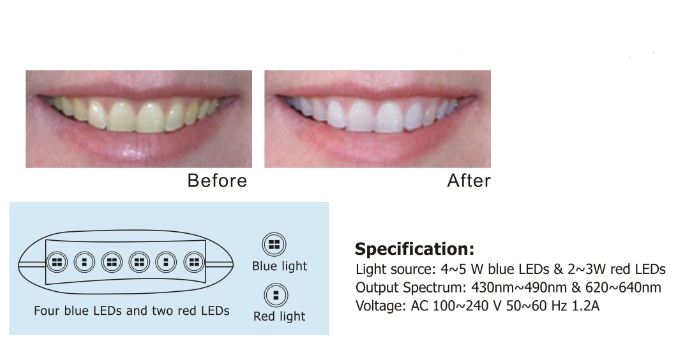 Dental Equipment/Teeth Bleaching Machine with Blue & Red Light