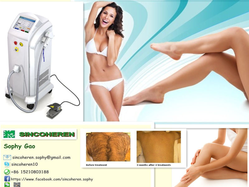High Power 808nm Diode Laser Hair Removal Machine