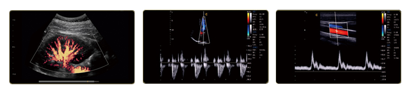 Ultrasound Scanner Color Doppler (SC-I9)