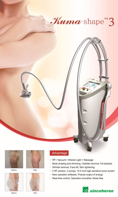 Hot Sale Acoustic Wave Therapy RF Vacuum Kuma Shape 3 Cellulite Removal