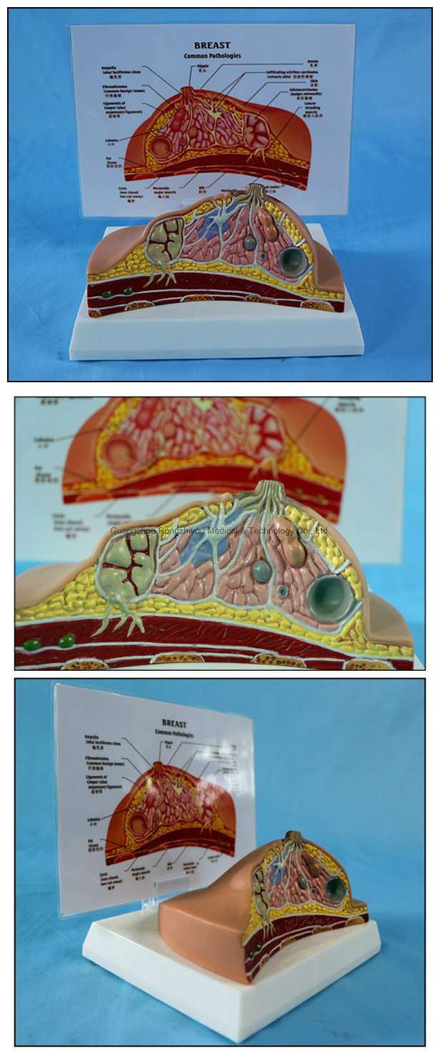 Desk Type Model Breast Anatomical Model / Pathological