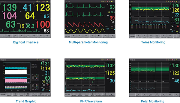 12.1inch Fetal Maternal Monitor Fetal Doppler Ultrasound Ultrasonic Touch Screen (SC-STAR5000C)