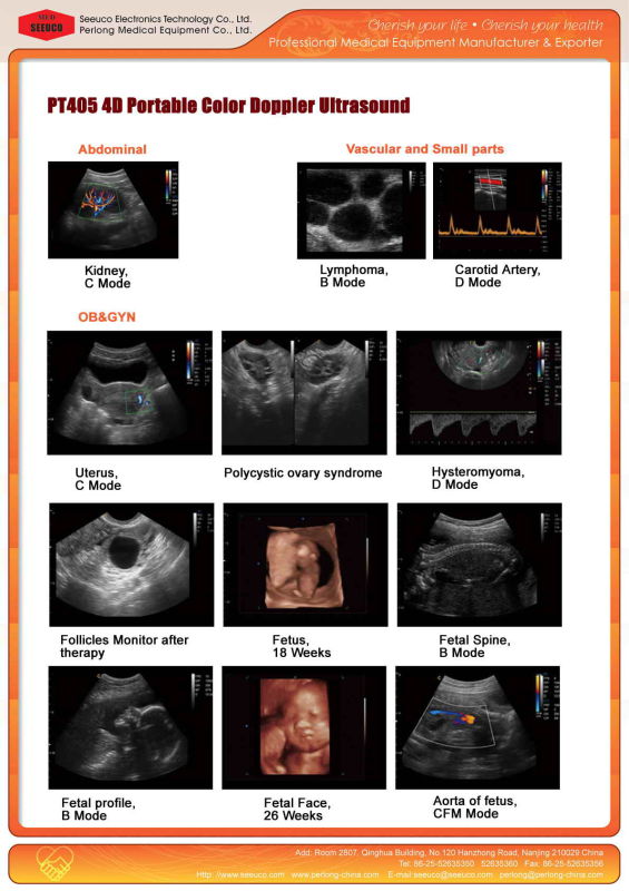 4D Portable Color Doppler Ultrasound Machine