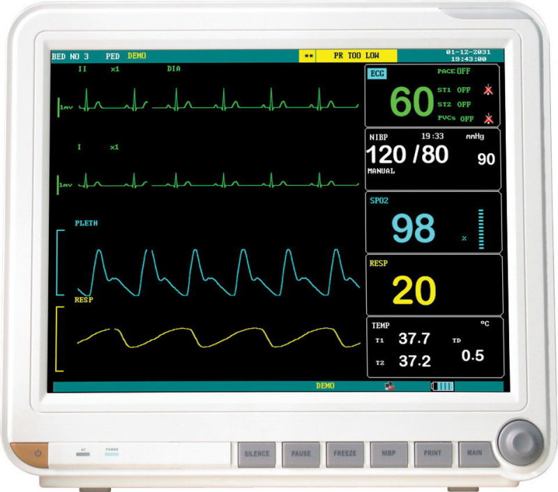 The Based Patient Monitoring System Using Processor