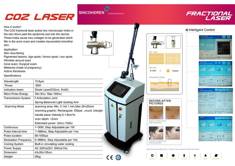 New Fractional CO2 Laser Machine