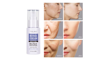 MELAO Hot selling Private Label Natural Anti Aging Wrinkle Whitening Dark Spot Removing Retinol Peptide Face Cream1