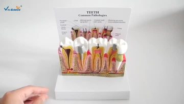 Dental model