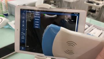 cheap ultrasound scanner Wireless probe