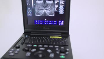 K7 Laptop Medical Veterinary Ultrasound